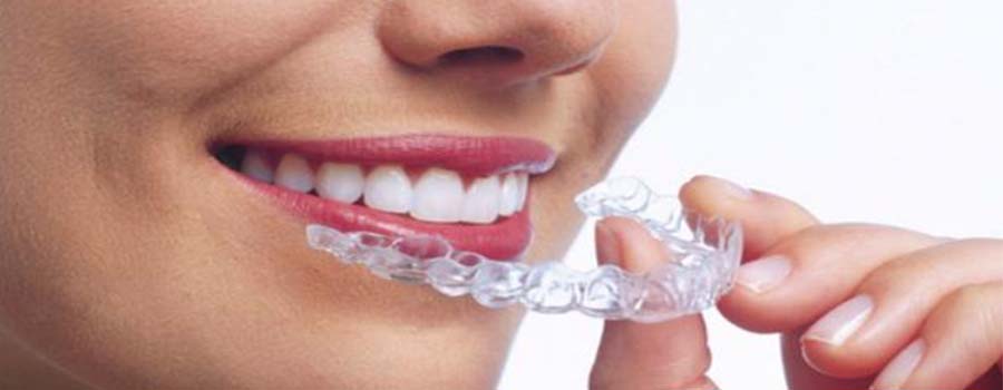 Asha Dental Clinic Orthodontic And Implant Care